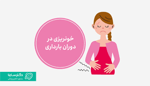 پاورپوینت کامل با عنوان خونریزی های نیمه اول بارداری