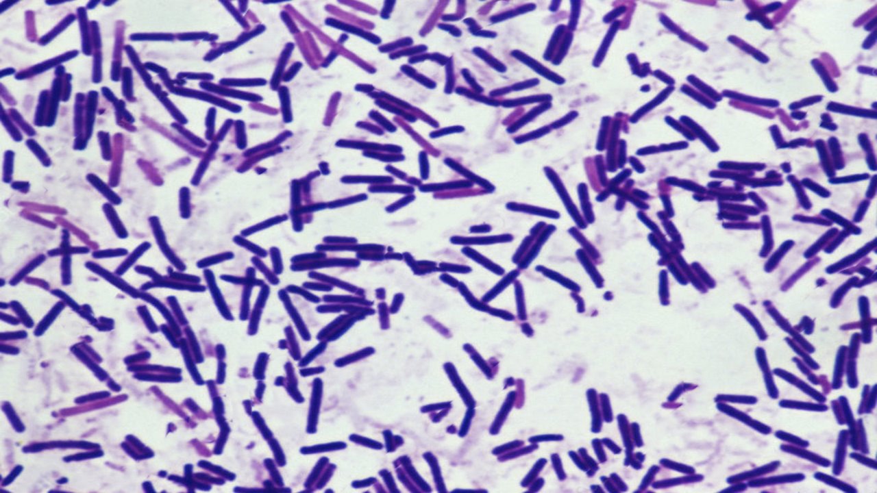 پاورپوینت باسیل های گرم- اسپورزا-باسیلوس ها و کلستریدیوم ها